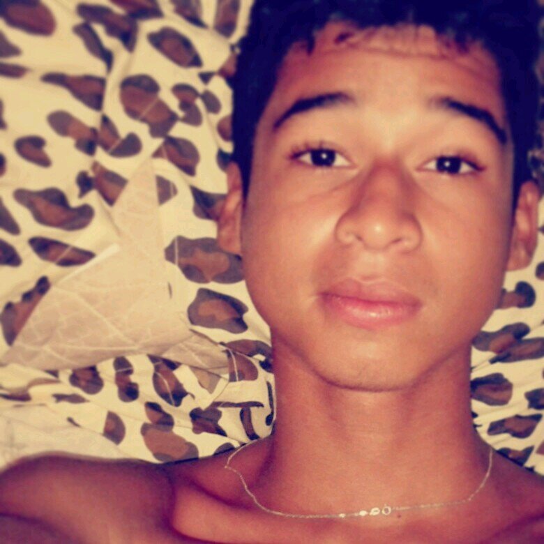 [SCR](L)