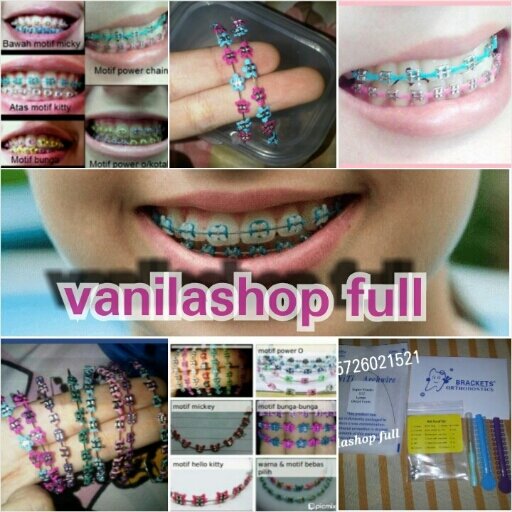 Jual perlengkapan behel murah . Behel lepas pasang 68rb free ongkir. Instagram @vanilashopfull dan @juraganbehel. WA 08978330191 / line dental_kit