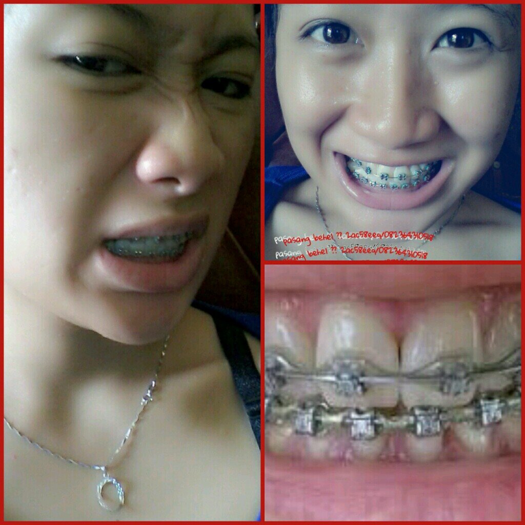 Diandra_Langid's profile picture. Behel shop | kemeja | kecantikan | 082364310518 | 2AC58eea