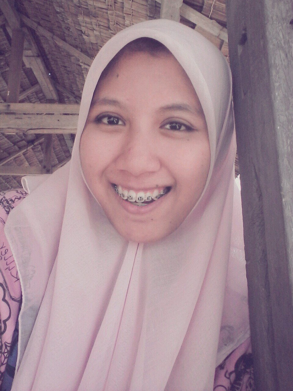 FiraJoy's profile picture. Medical Surgical Nursing at Ministry of  health|Aceh Health Polytechnic'13