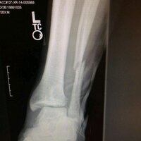 JohnDavid (@jdblpseelig) 's Twitter Profile