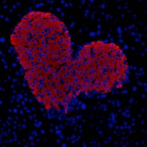 Defeating diabetes with Science