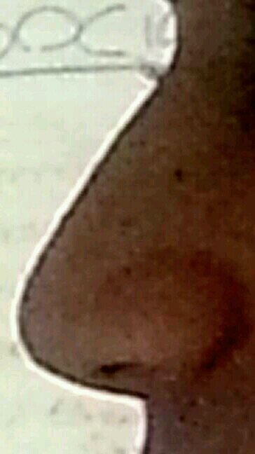 Hi I'm Matt's nose. 
Your average nose model #chasingthedream. Follows  support my journey to the top of the nose modeling industry. The nose nose.- JFK