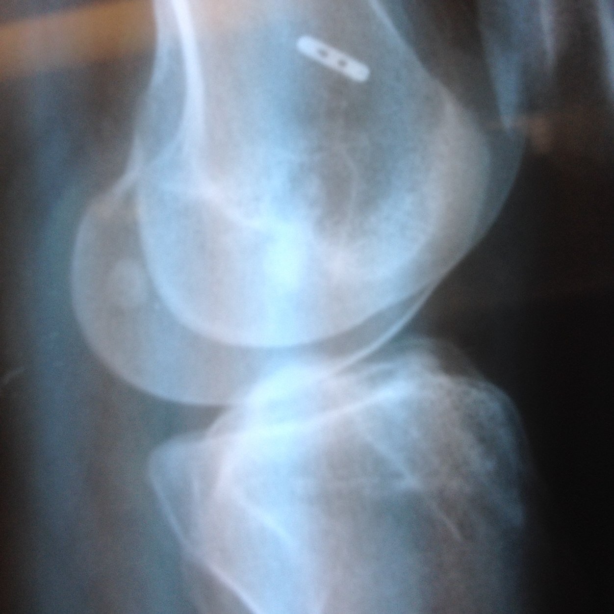 aclforall's profile picture. 