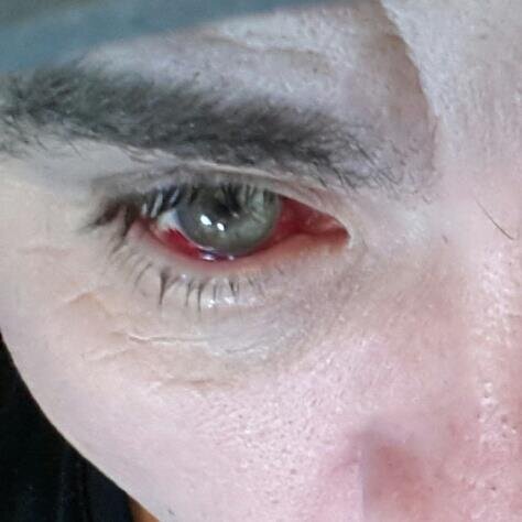 Eye Surgeon