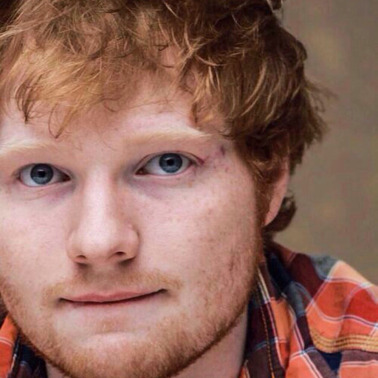ED