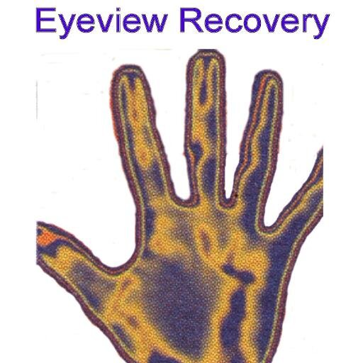 EyeViewRecoverY's profile picture. 
