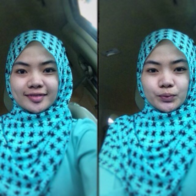 Medical faculty student , Hasanuddin University