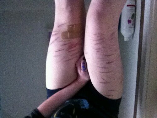 just13|broken|i dont give a fuck|just wanna kill myself|selfharmer|suicidal.