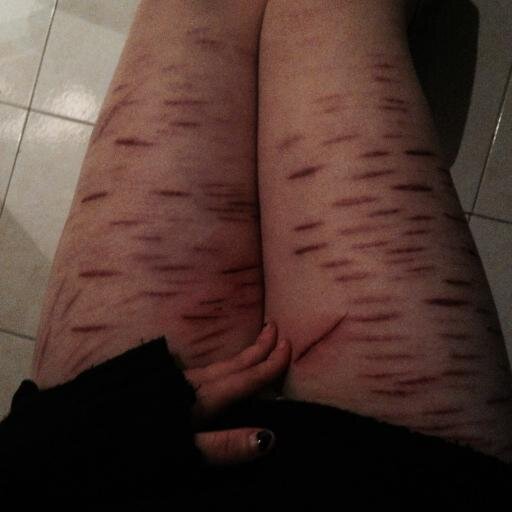 Una chica de 15 años con mas daños que una de 100.