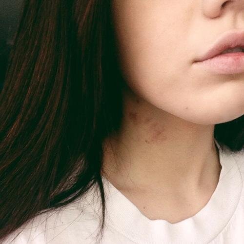 15. ♡