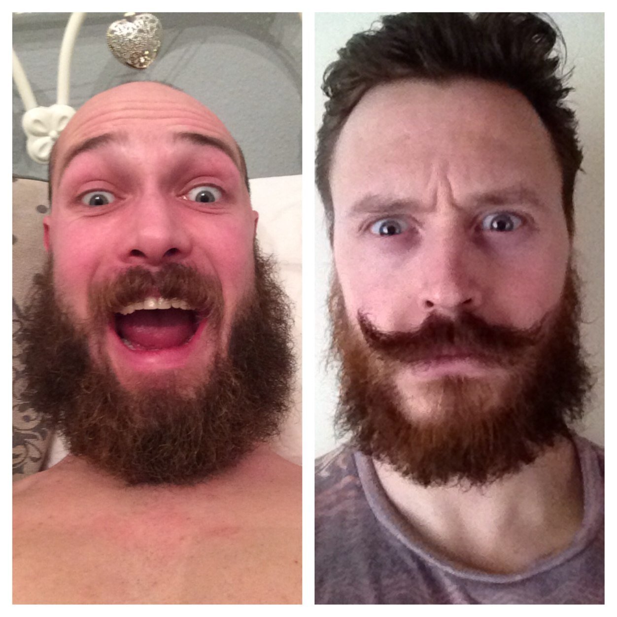 Two young scottish gentleman growing beards in a friendly bet against each other with all proceeds going to cancer research. For more information please visit