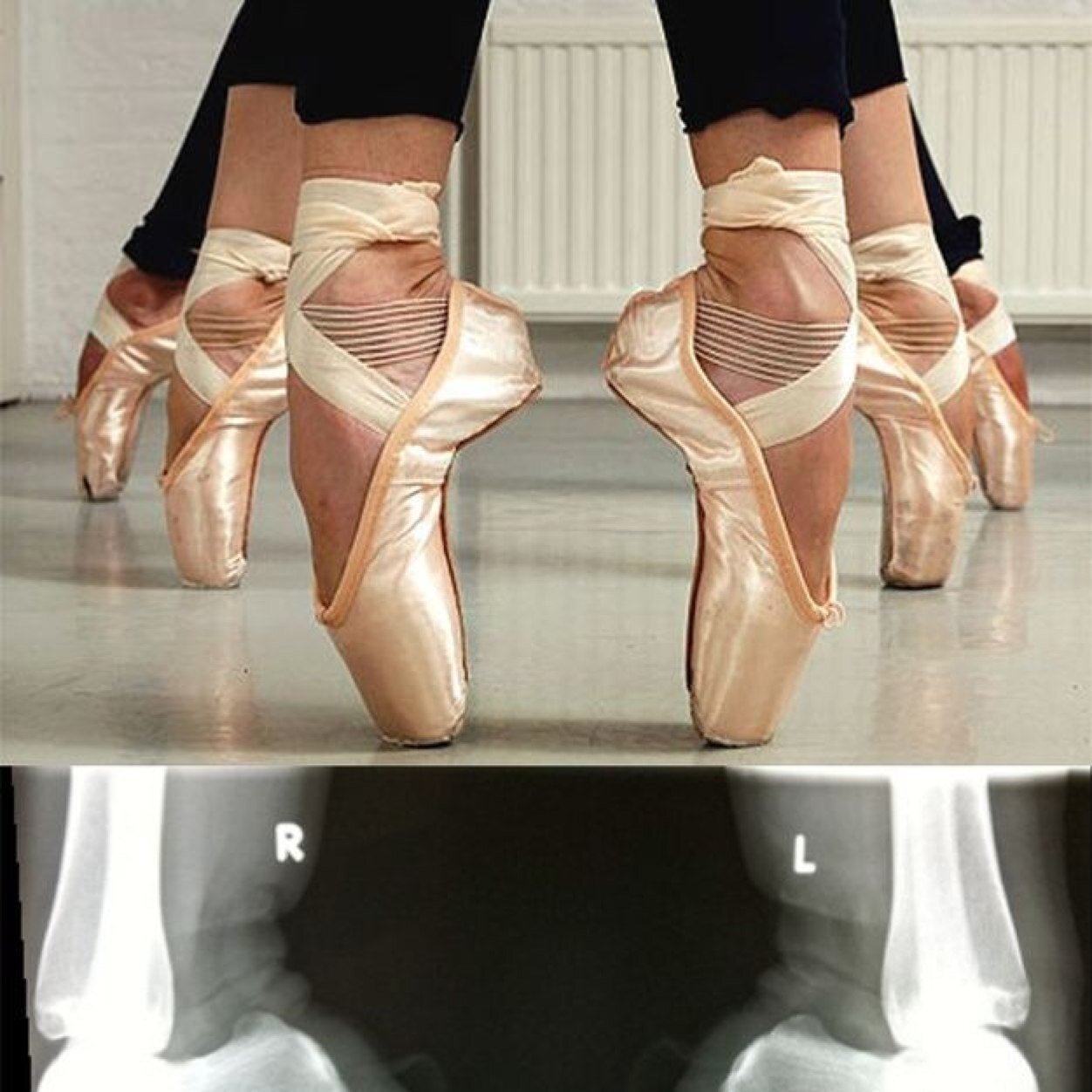 katier323's profile picture. We stop looking for the monsters under our bed when we realize the monsters are inside our head ❤️