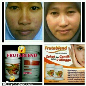 Info & order chat me..PIN : 74949178 & 7651771C / sms or WA : 081804357261