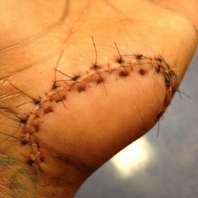 Bad Injuries (@badinjuries01) / Twitter