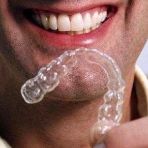 tellerimcokos's profile picture. Ağız yüz parçalamaktan sıkıldım artık biraz tivit atayım eheh #Saü