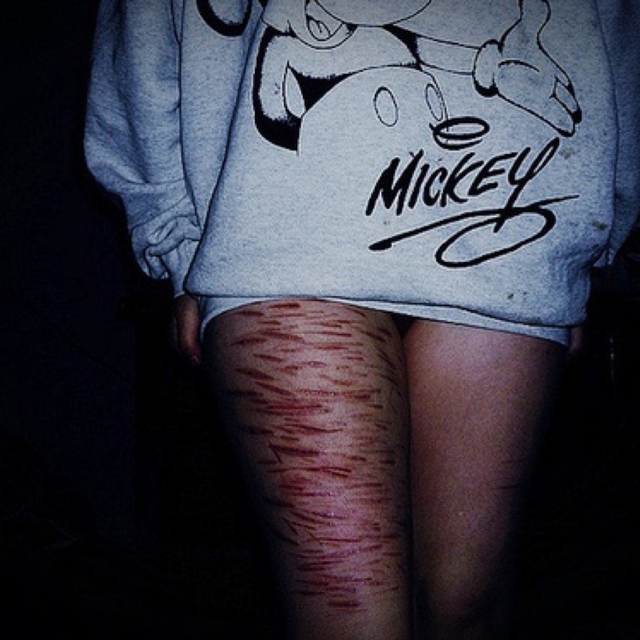 16 • suicidal • depressed • OCD • anxiety • selfharm • sad