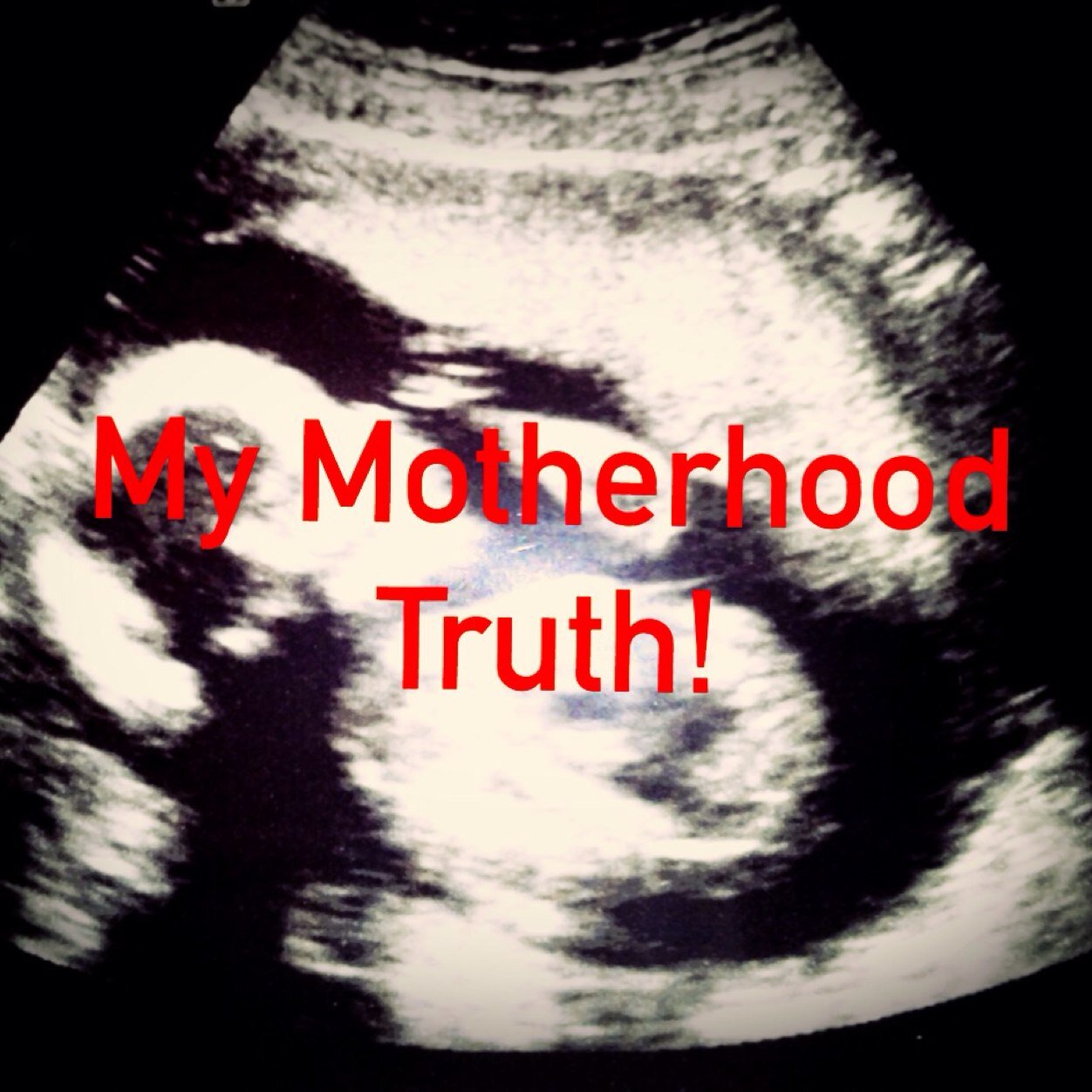 My truth about pregnancy & babies