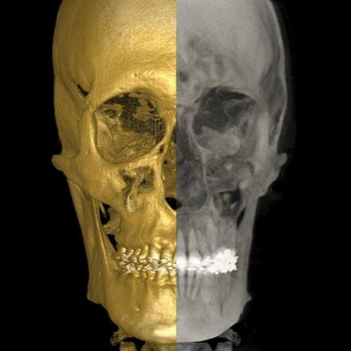 Tomografía Dental Digital - Rx Panorámica y Tele Rx Digital - Trazados Cefalométricos - Seriada Digital - Fotografía y Modelos Zocalados para Ortodoncia.