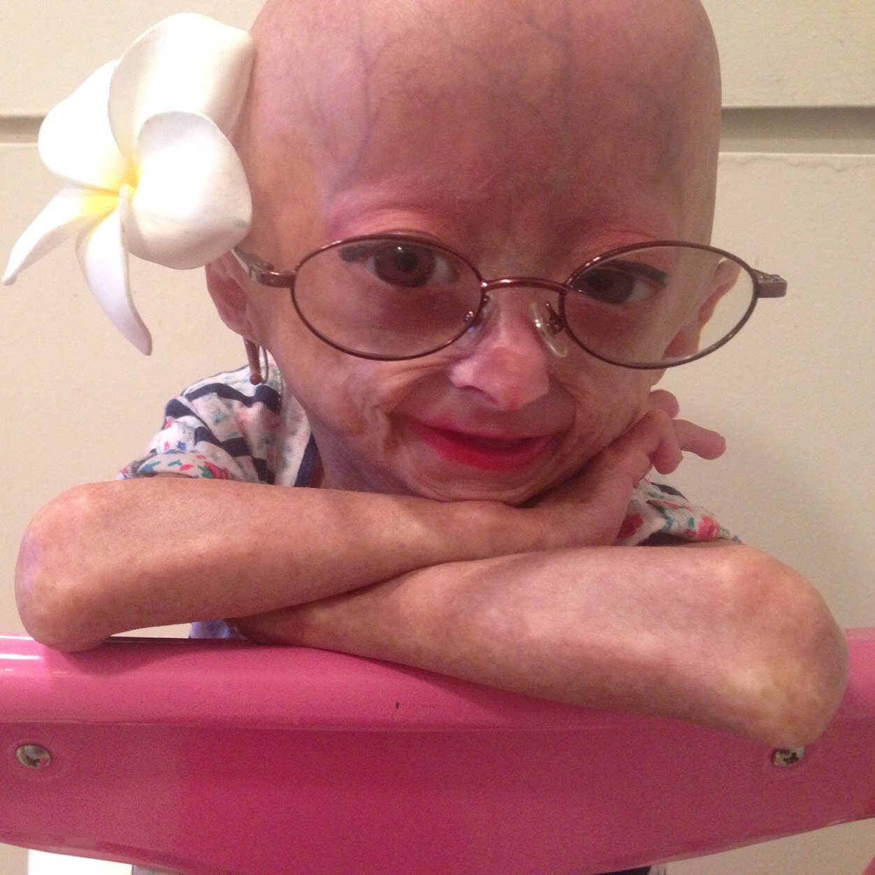 Adalia is so many amazing things, but above all she is our inspiration. This is the official Twitter account for Adalia. We are #TeamAdalia
