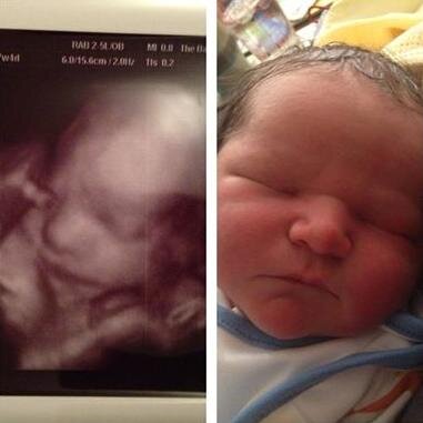 All of our baby ultrasound scans 3D or 4D are performed by fully qualified ultra sound / midwifery practitioners