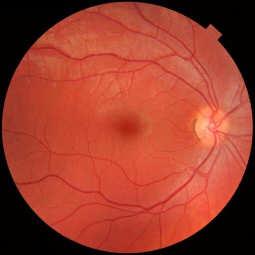 Developing expertise in ocular motility