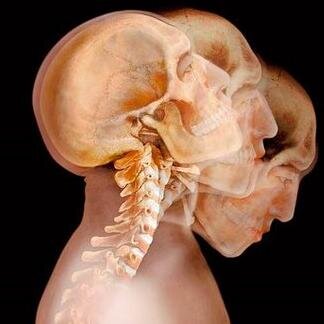 Información sobre el curso Prescripción ejercicio terapéutico cervical y lumbar. Práctica basada en la evidencia. Aportes de evidencia científica.