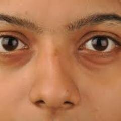 32. Male. That is all.