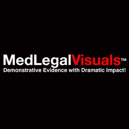 MedLegalVisuals  Demonstrative Evidence with Dramatic Impact! Case specific medical trial exhibits for all types of personal injury & medical malpractice cases.