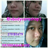 @yuniartiT (@vbodycareshop1) 's Twitter Profile