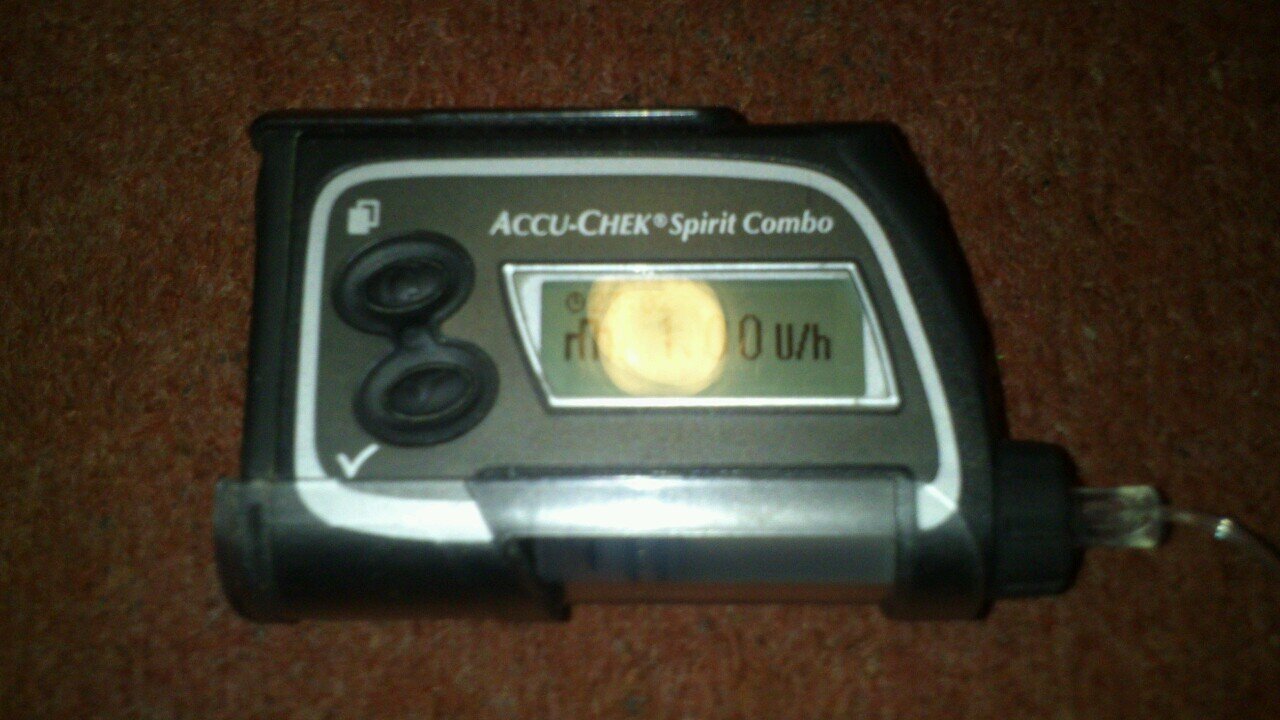 T1D - AndroidAps with Combo - Dexcom G5 (by choice!)