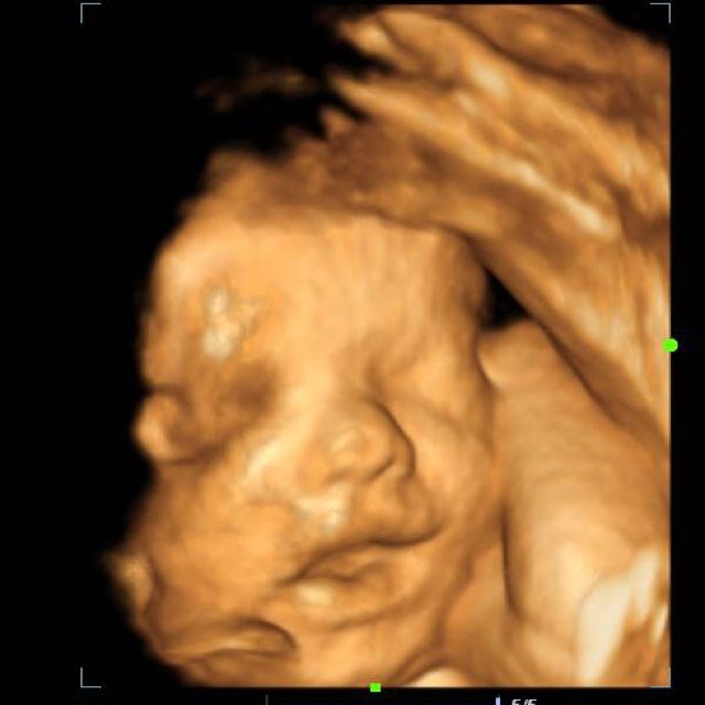 Ryacrawford's profile picture. Nurse. Instructor. Troublemaker. Organizer. Traffic jam Rockstar. Coffee ninja. Gamecock. Life is short but sweet for certain!