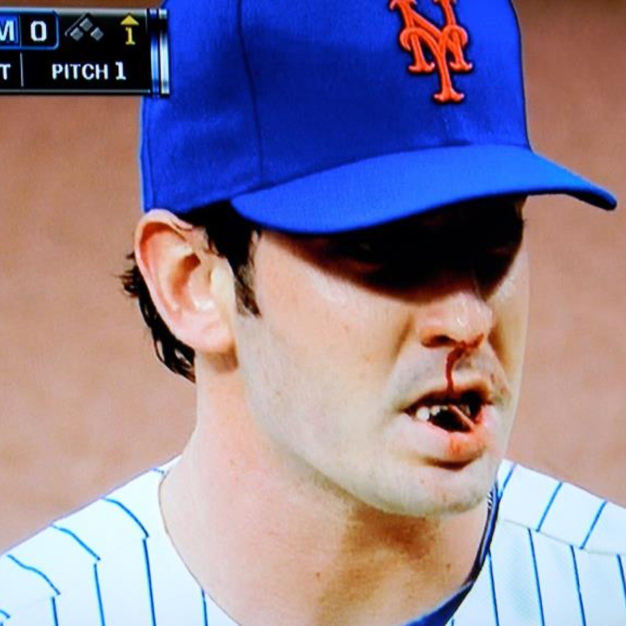 Lets go Mets!!!! Fuck the Phillies!!!!
