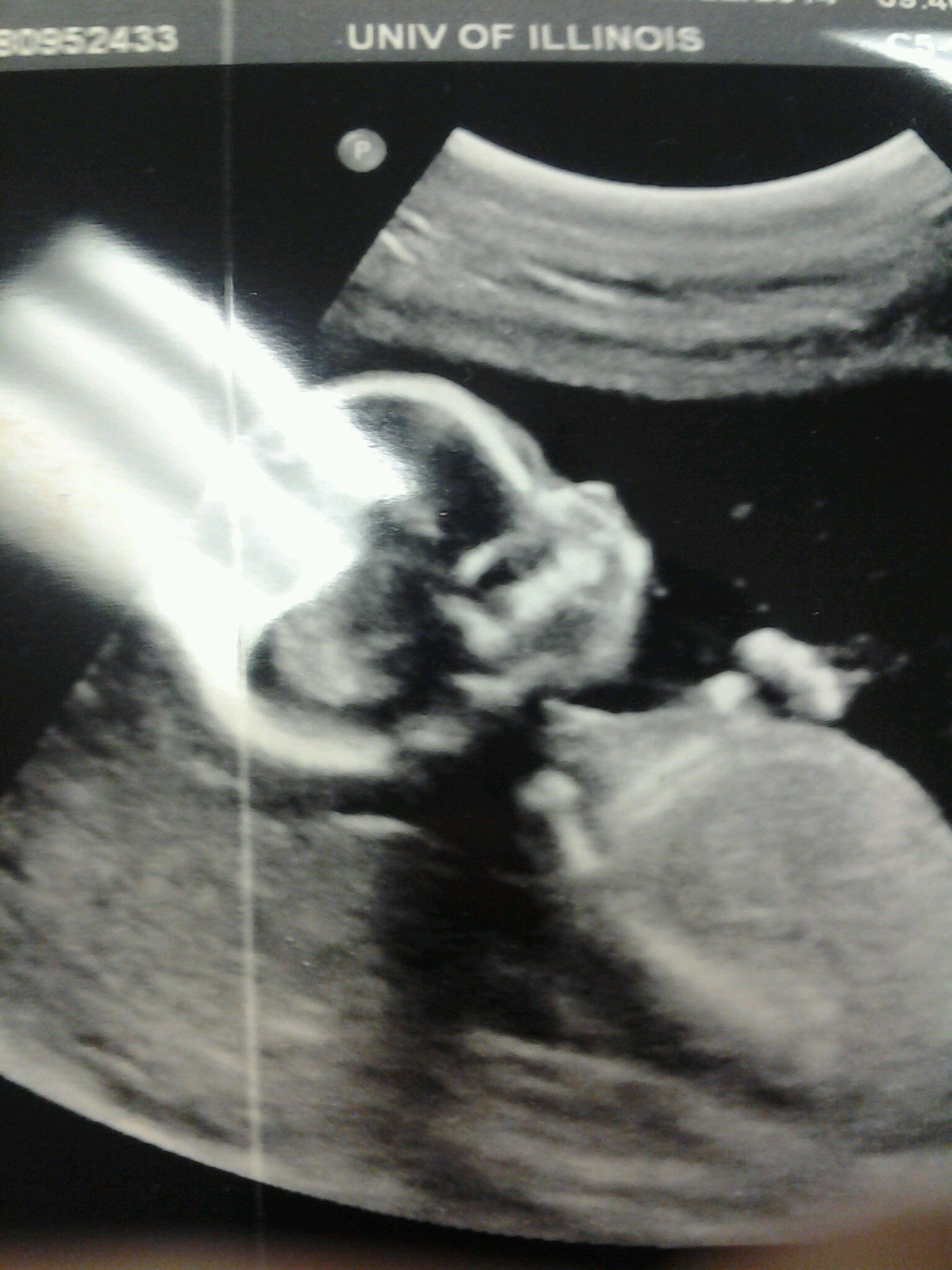 Thee Name: Amber L. Johnson;October 29th #TeamScorpio #TeamRedBone #NoBullShit #TeamFollowBack #TeamICanTakeYoNigga #TeamNoTitties #TeamFatAss