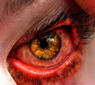 hitman9151's profile picture. You can find me at http://t.co/aXFvPxpUT9