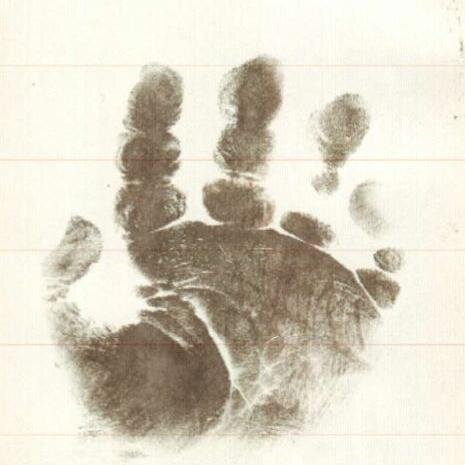 frankieslegacy's profile picture. Surviving stillbirth, celebrating Frankie (born sleeping 29/11/13), creating his lasting legacy. Raising awareness of cleft lip/palate & chromosome disorders.