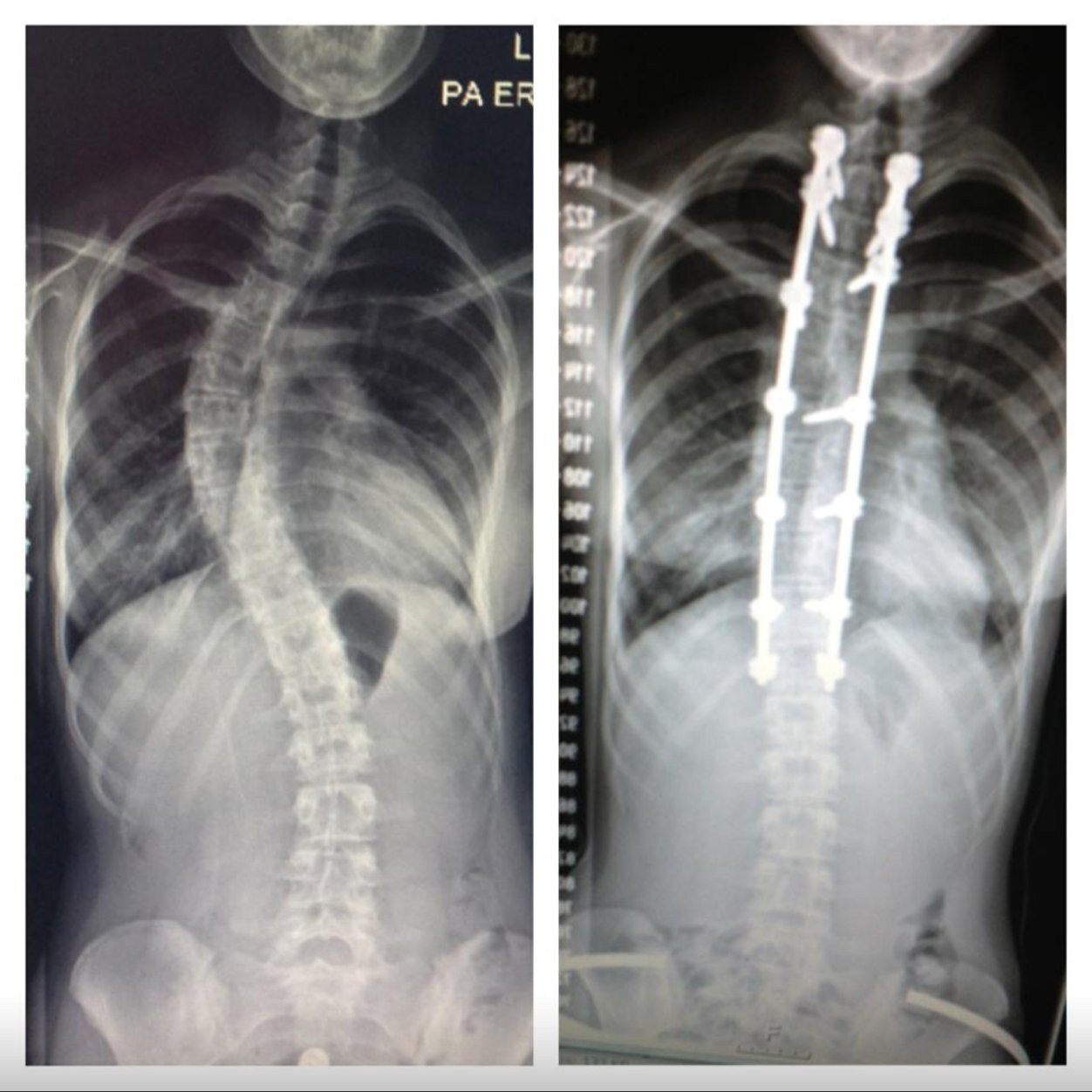 Straight spines are way to mainstream
http://t.co/0sjRfNeCLS