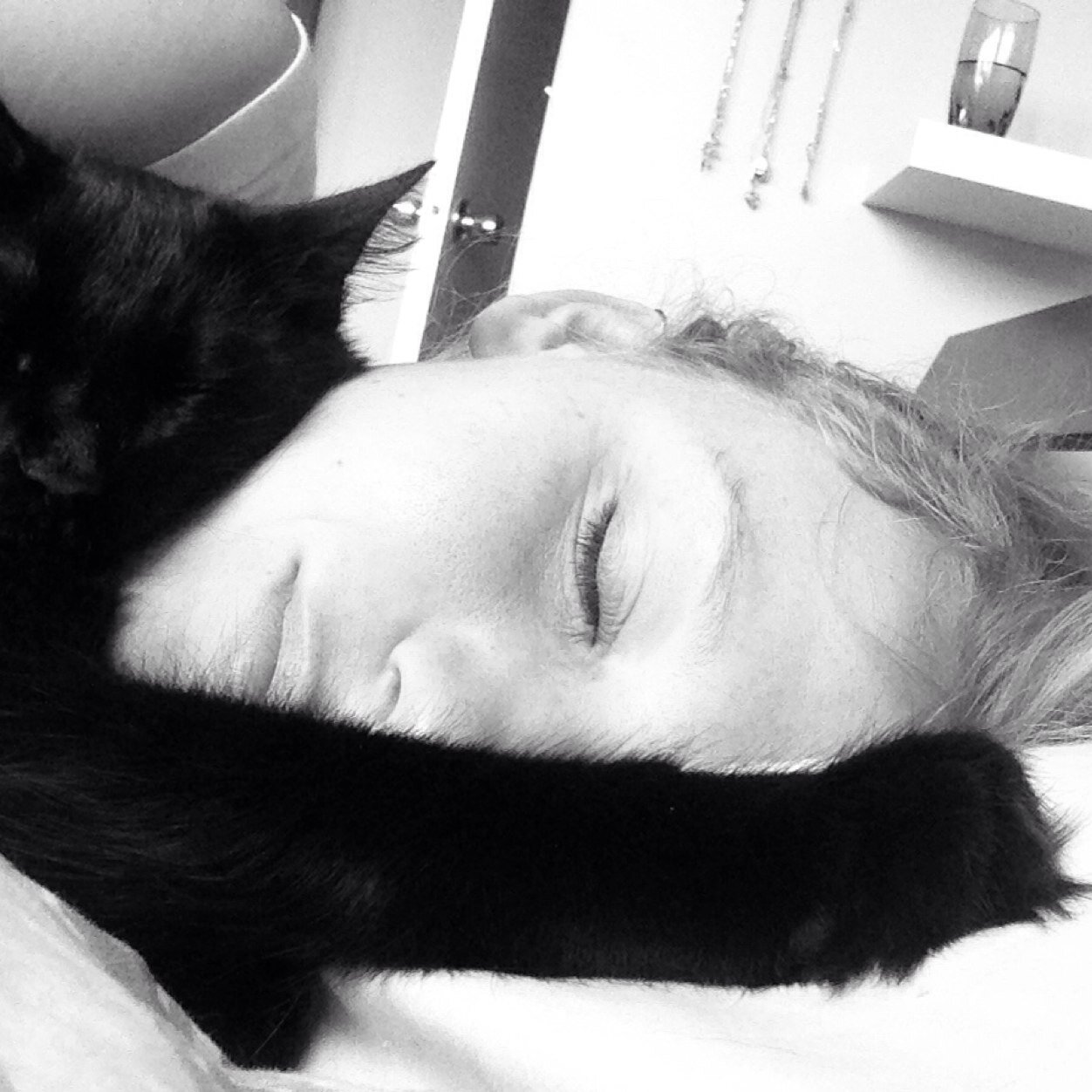 Chronic fungus from my cat sleeping on my face...