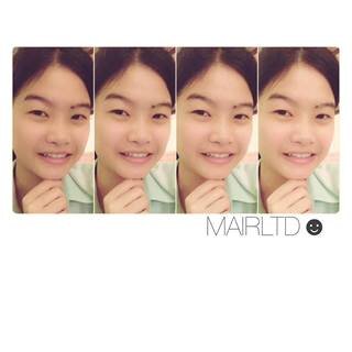 I'm Mild. 16 year old.  Thank for me. ♥♥