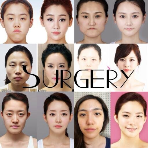 This page is about the positive and negative aspects of surgery. Please share your experiences with us!