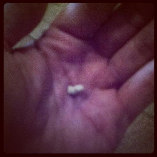 djb_kidneystone's profile picture. I'm @danajaybein 's kidney stone.