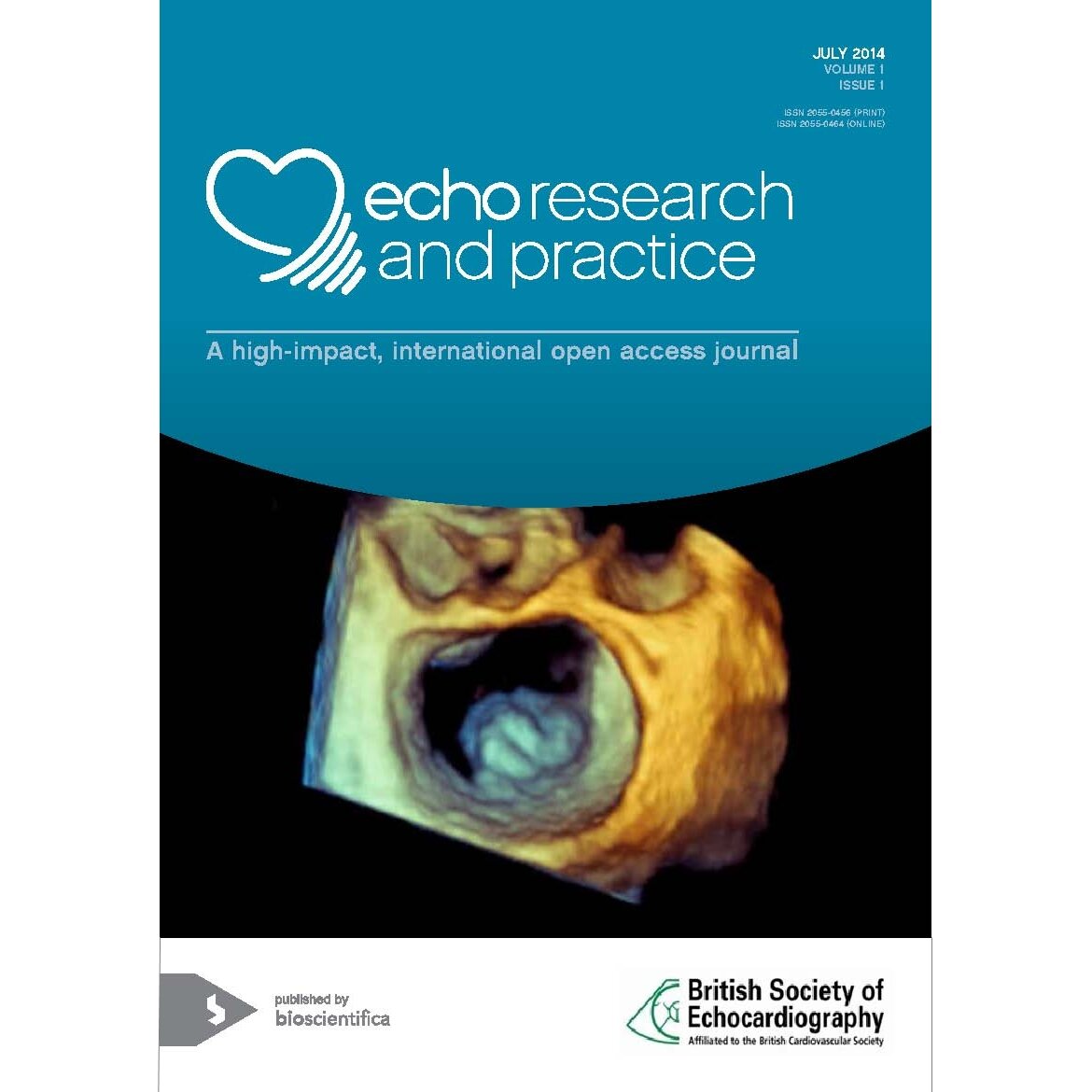 A high-impact, international open access journal from the British Society of #Echocardiography. #openaccess #FOAMed #FOAMus @BSEcho