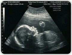 ChristopherM_LD's profile picture. 4 meses. // Pequeño de Maureen y Jonathan // Minipiromano // De mayor seré sexy //