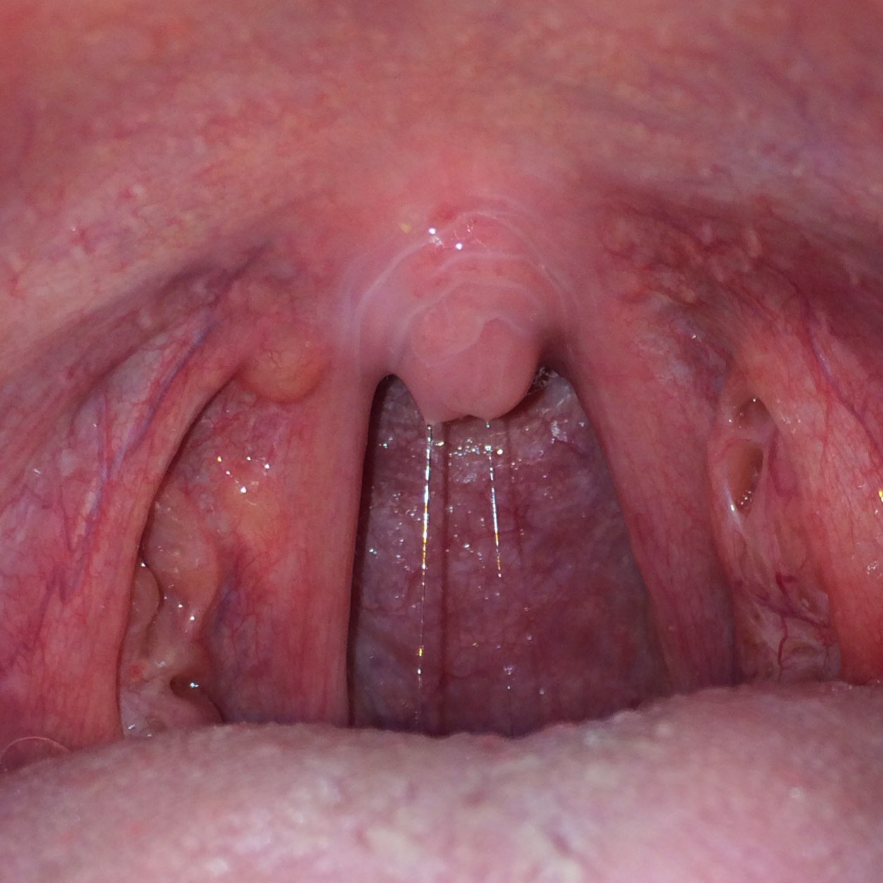 Very nude girl uvula apologise, but Nude girl uvula suggest