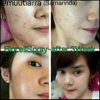 Stay Young, Stay Healthy, Stay Beautiful With Moment.. Flek Hitam, Jerawat, Keriput, Wajah Kusam, Tidak Bercahaya Lewat Deh.... 
Wa 082293757502
BBM 5CEC981F