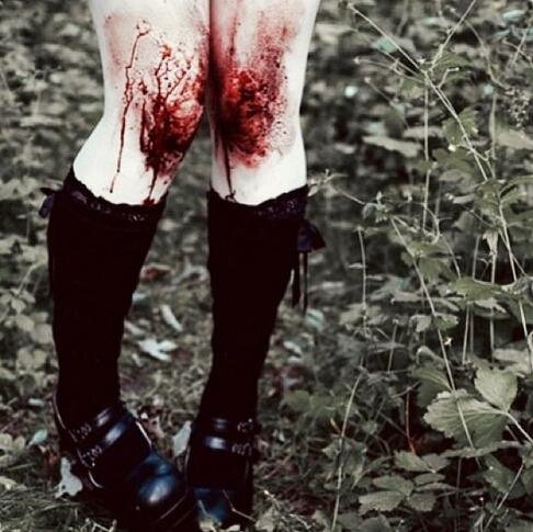 - girl - 14y/o - dutch - bvb saved my life - bands - batman - rain - damaged - SH - ED - bi - insta - kik - wapp - always here to talk -
