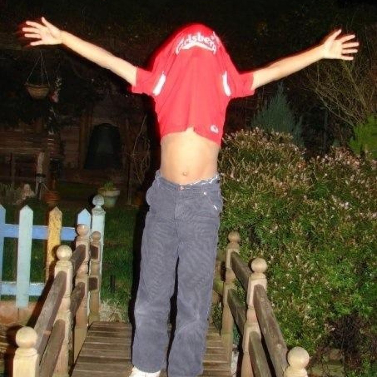 I chizzle my anus