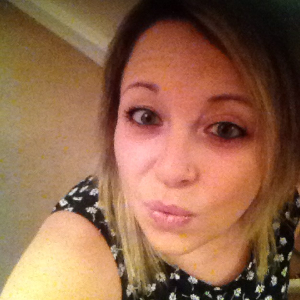 24 year old endo sufferer xx #endosisters #cornwall #followme