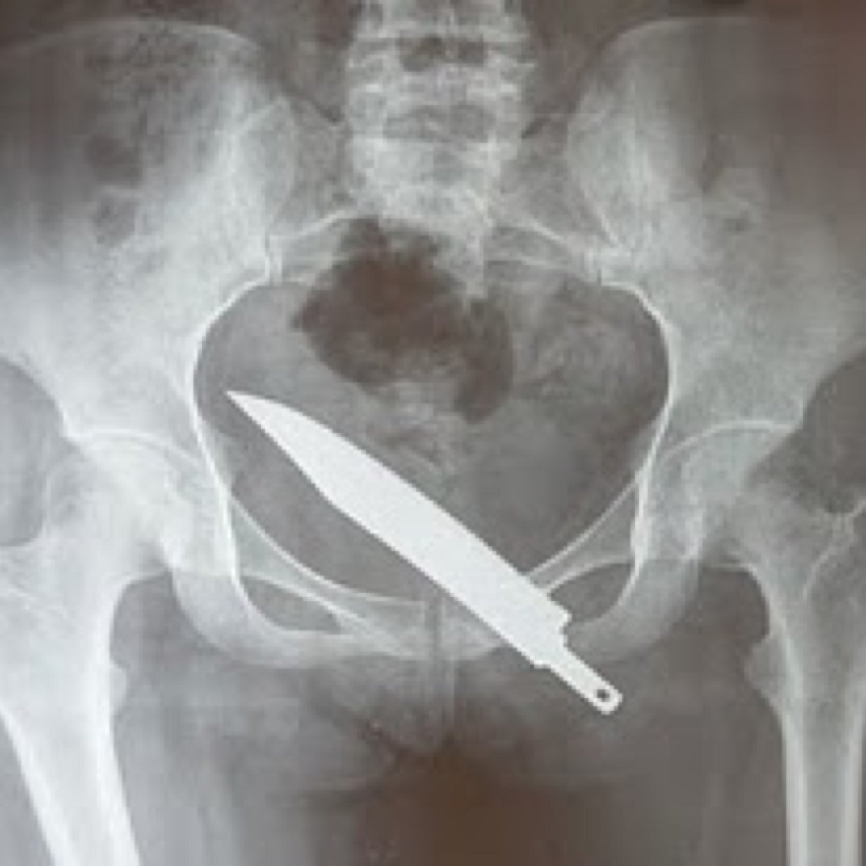 Here i come to shank your ass Follow me and ill follow you back...... Probaly. MSG me for a shoutout