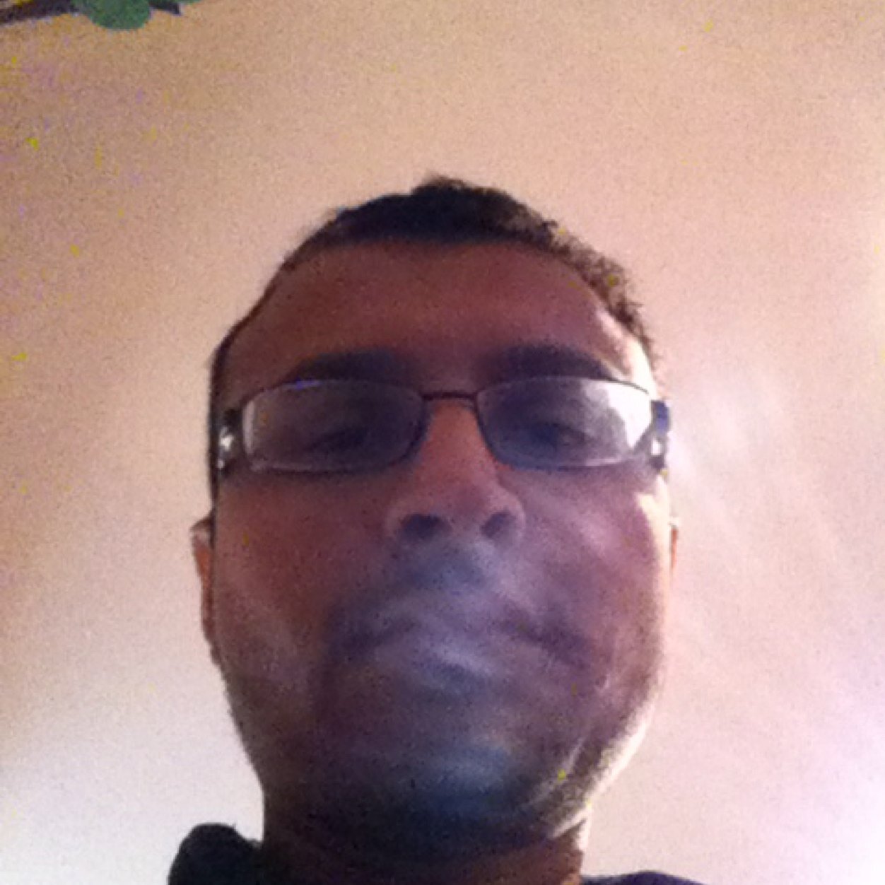 NehalNehalsr's profile picture. This is 1 my ugliest moment ? So now tell me whats Up? No really What is ^. Living through Steven s Johnson syndrom is not Fun its more like Pain!!!